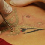 The Facts About Tattoo Removal